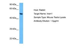 INSM1 Rabbit anti-Mouse, Polyclonal, Novus Biologicals 0.1 mL | Buy Online | Novus Biologicals | Fisher Scientific